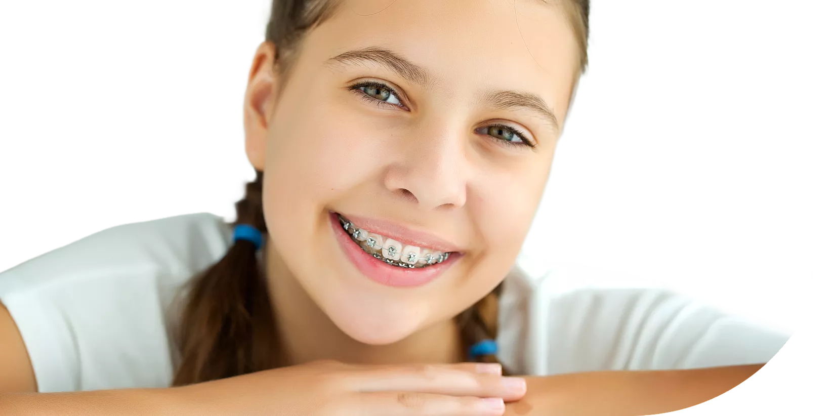 Types of braces
