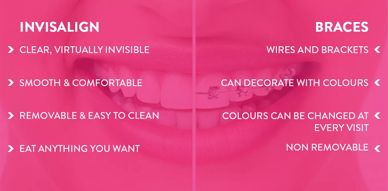 Braces or Invisalign: Which is Right for Me?